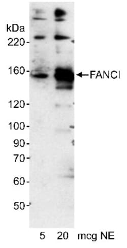 FANCI Antibody, Novus Biologicals 0.1mL; Unlabeled:Antibodies, Polyclonal